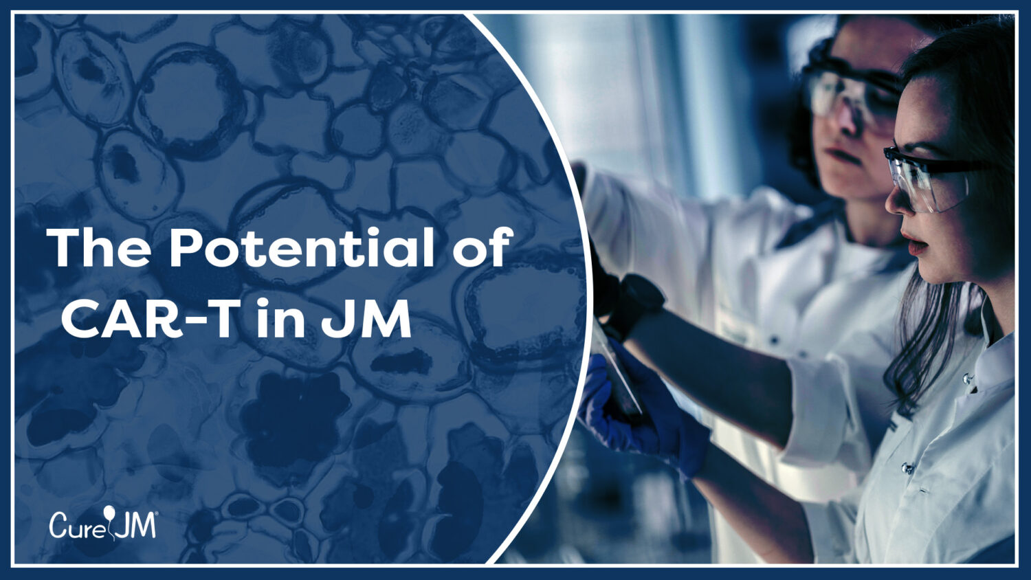 The Potential of CAR-T in JM